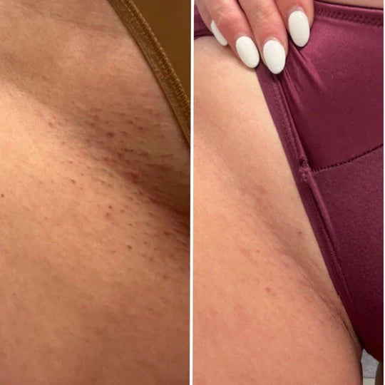 Dear Kitty™ Intim lysnende creme